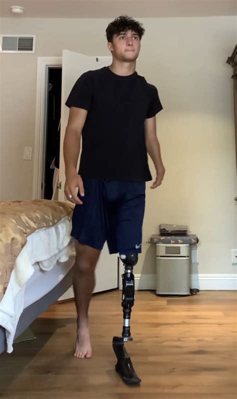 Gay Amputee Fetichism And Others