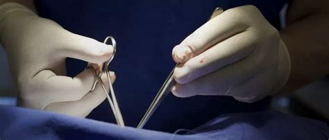 Anal Fist L Tedavisi Op Dr Mustafa Co Kun Obezite Cerrahisi