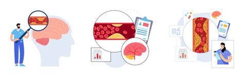 Best Foods That Prevent Stroke