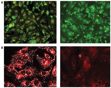 Human iPSC-Derived Cardiomyocytes