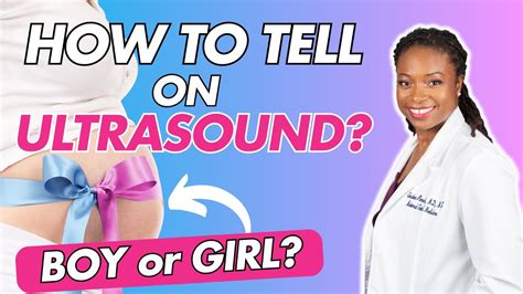 How To Tell Baby S Sex On Ultrasound YouTube