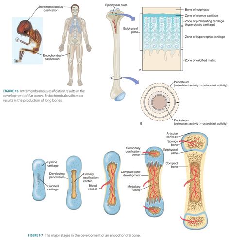 Endochondral Ossification Vs Intramembranous Ossification