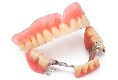 Бюгельные протезы под ключ - Доверие