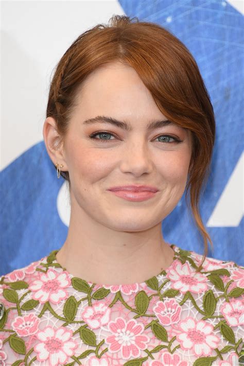 emma stone face lift 11