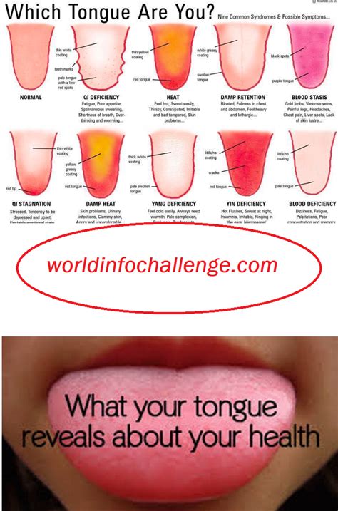 Allergy Symptoms On Tongue At Dorla Walker Blog
