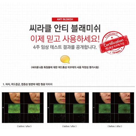 Точечное средство Ciracle Anti-Blemish Spot A-Sol – купить в Москве ...