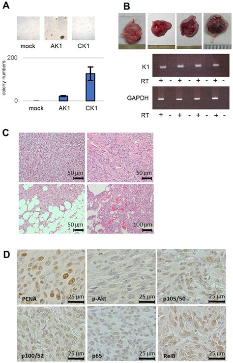 Anchorage Independent Growth And Tumorigenicity In Nude Mouse Of