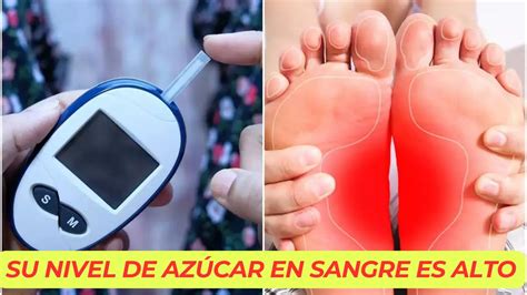 16 Señales Alarmantes De Que Su Nivel De Azúcar En Sangre Es Alto Y 8