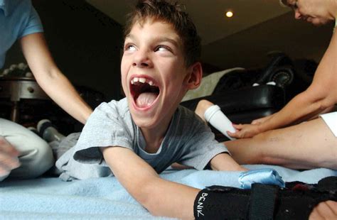 Cerebral Palsy In Babies Characteristics Of Cerebral Palsy