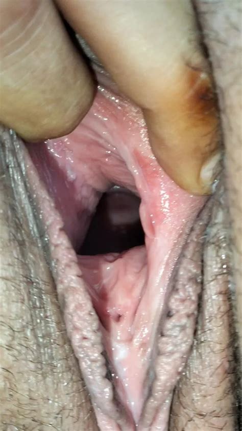 Cum Covered Cervix Nude Pics XHamster