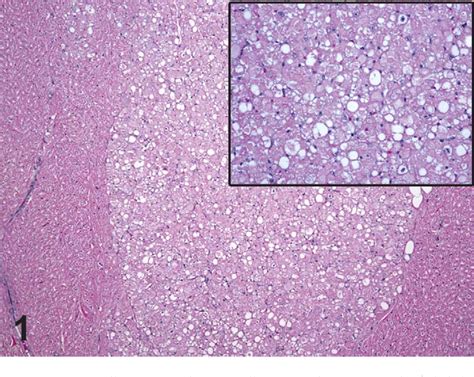 Figure 1 From Canine Cardiac Rhabdomyoma Semantic Scholar