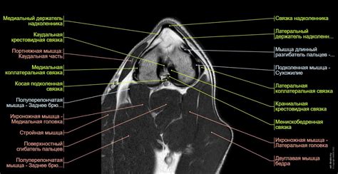 Собака ‒ Коленный сустав MPT - нормальная анатомия | vet-Anatomy