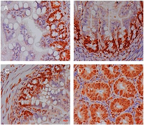 Photomicrograph Of The Isogenic Fetal Small Bowel Graft After Seven