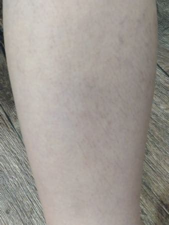 Close Up Of Milf S Hairy Pussy Pics Xhamster