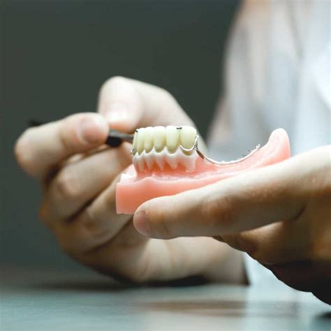 Denture Repairs Calgary Swiss Denture Clinic