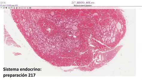 Histolog A Del Tiroides Y El Paratiroides Youtube