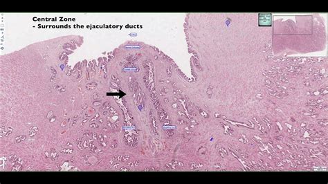 Histological Structure of the Prostate 4K - YouTube