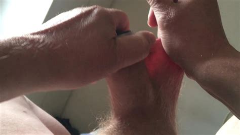 Sunshine Foreskin Five Minute Video Plastic Container Gay Amateur Amateur Porn XHamster