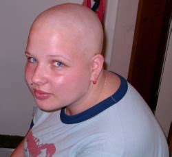 Bald Barefoot Bi Babe On Tumblr