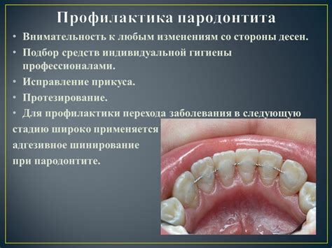 Методы лечения и профилактики гингивита - симптомы заболевания