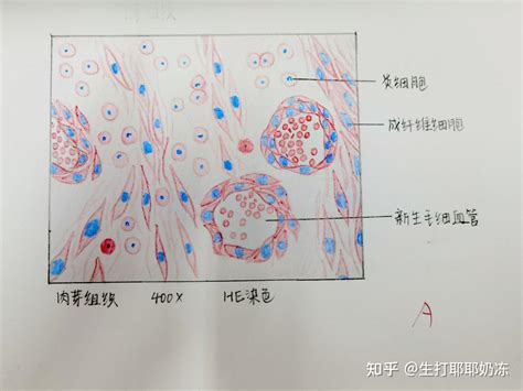 病理红蓝铅笔绘图 知乎