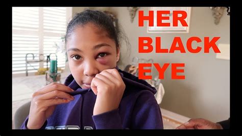 Her Black Eye Youtube