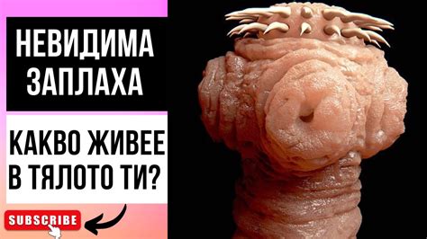 ПАРАЗИТИ В ТЯЛОТО? 9 ИЗПИТАНИ ПРИРОДНИ СРЕДСТВА ЗА ПРЕЧИСТВАНЕ ОТ ...