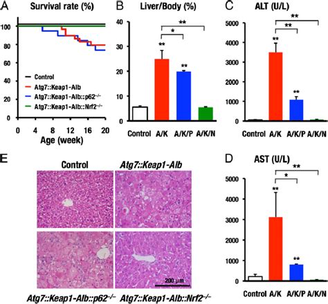 Nrf2 is a definitive factor of liver injury in impaired autophagy. The ...