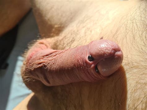 Cock Banding Session With Elastrator Bands Nude Pics Xhamster