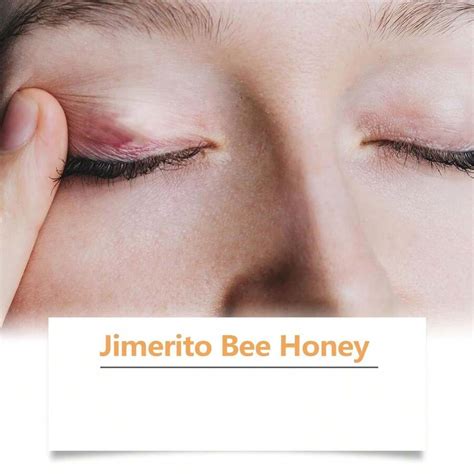 Jimerito Honey For Eyes, Jimerito Honey Eye Drops, Jimerito Bee Honey