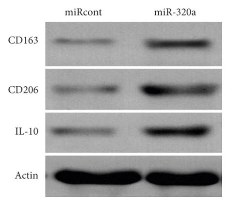 Mirna 320a Facilitated Macrophage M2 Polarization Qpcr Analysis Of