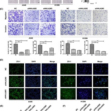 Knockdown Of Hhla2 Inhibited Nsclc Cell Migration Invasion Via Download Scientific Diagram