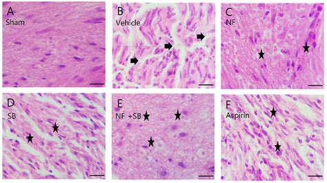 Representative Hande Staining Of Sciatic Nerves On 14th Day After Download Scientific Diagram