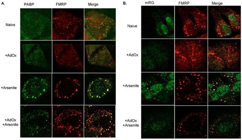 Arsenite Induces The Accumulation Of FMRP In Stress Granules A HeLa