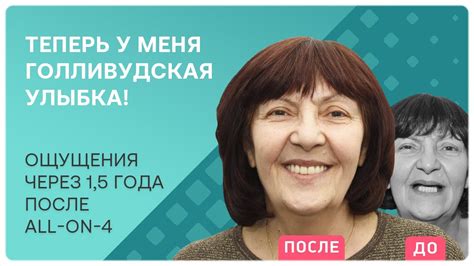 Мне снова 18! Отзыв после all-on-4 – ощущения после имплантации зубов ...