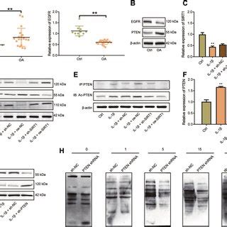 Sirt Overexpression Reduces Egfr Ubiquitination By Suppressing Pten