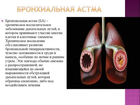 Бронхиальная астма у взрослых - презентация онлайн