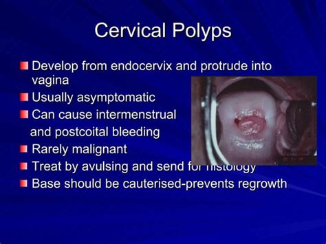 Benign Lesions Of The Cervix Vagina And Vulva Ppt Sexual Conditions Sexual Health