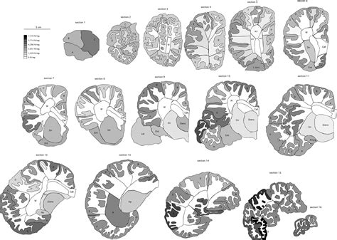 Elephant Brain Vs Human Brain