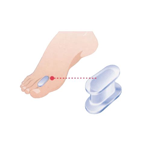 Pirkstu silikona retraktors / protektors – Medikom.lv