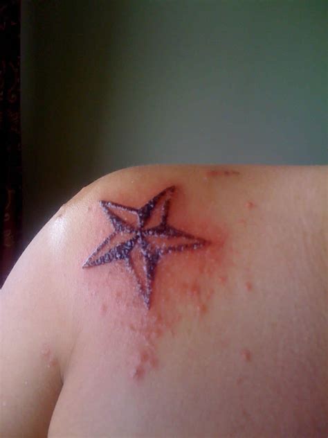 The Most Prevalent Causes of and Treatments for Tattoo Allergy - Wild