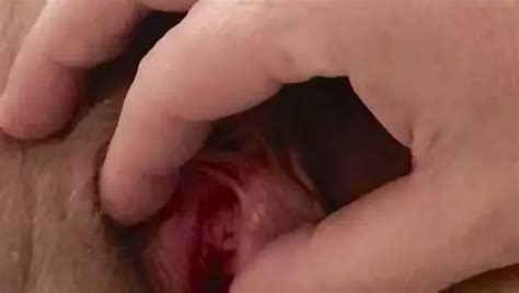 Delicious Hairy Pussy American Milf 14 Nude Pics XHamster