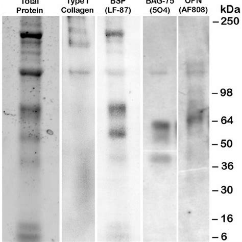 Western Blot Analysis Of Phosphorylated Bone Matrix Proteins Extracted Download Scientific