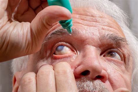 Todo Lo Que Debes Saber Sobre El Glaucoma Clínica Santa Lucia