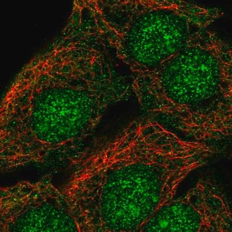 Anti SORCS2 Antibody Produced In Rabbit