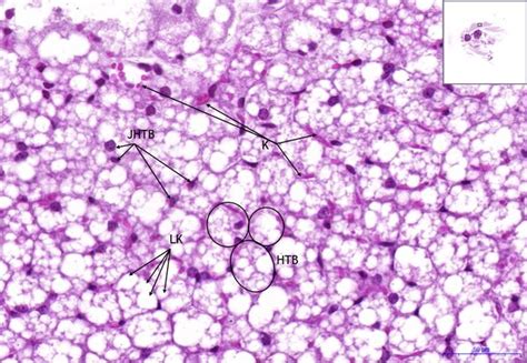 Brown adipose tissue - HE - WikiLectures