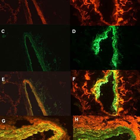 Representative Photomicrographs Of Double Immunofluorescent Staining