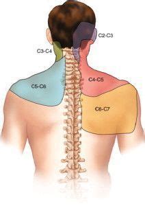 Cervical Dermatome Map | Physical therapy, Massage therapy, Occupational therapy