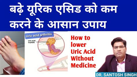 Uric Acid Ko Jad Se Khatam Karne Ka Upay Andre