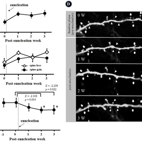 Representative Auditory Related Extracellular Multi Unit Response